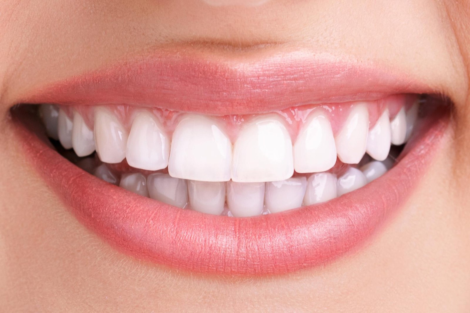 Teeth whitening clinical outcome